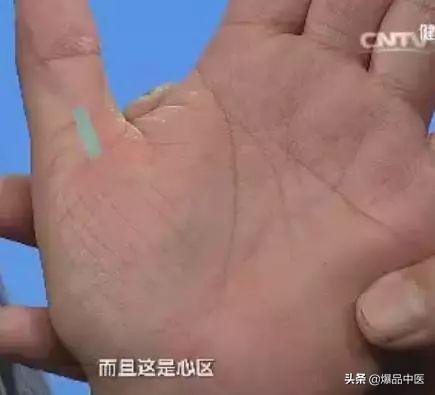 手是健康的镜子，10种常见病，从手上就能看出来