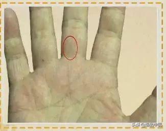 手是健康的镜子，10种常见病，从手上就能看出来