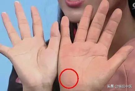 手是健康的镜子，10种常见病，从手上就能看出来