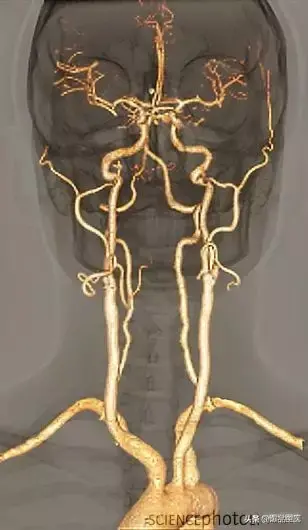 神经系统一天搞定，打破死板记忆方法