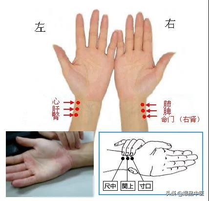 脉诊图画及脉歌，太珍贵了