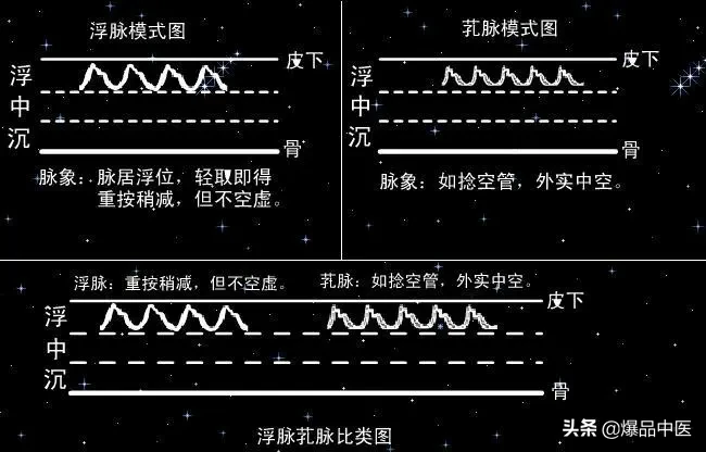 脉诊图画及脉歌，太珍贵了