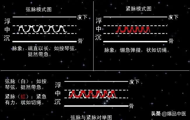 脉诊图画及脉歌，太珍贵了