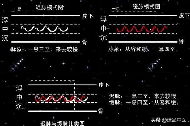 脉诊图画及脉歌，太珍贵了