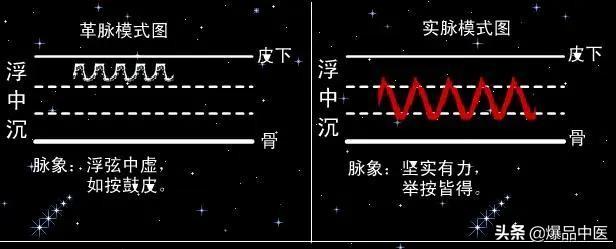 脉诊图画及脉歌，太珍贵了