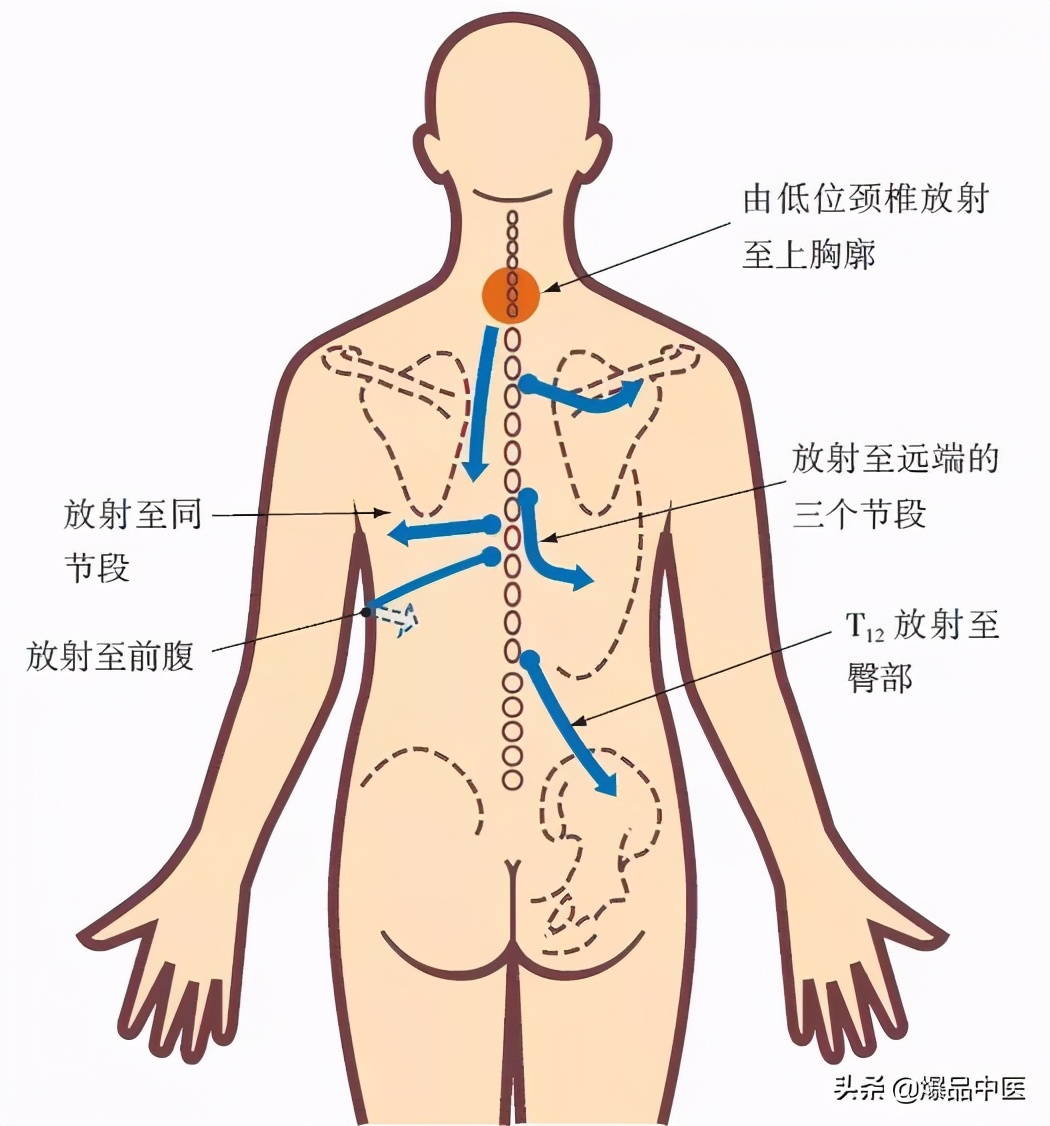 疼痛干货—全身筋结点,帮助诊治分析