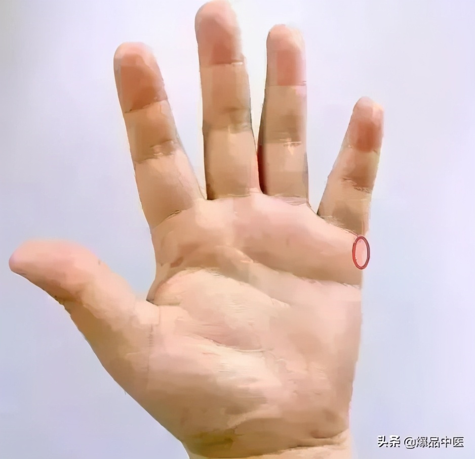 一个奇穴,专治各种“不通”