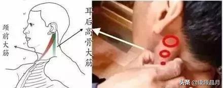 记住这三条筋,能治很多病