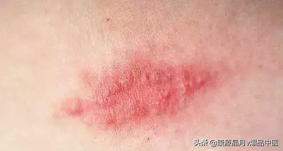 警惕!内脏有癌,皮肤先知