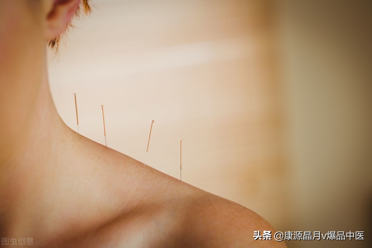 针灸:一切气病,先开四关