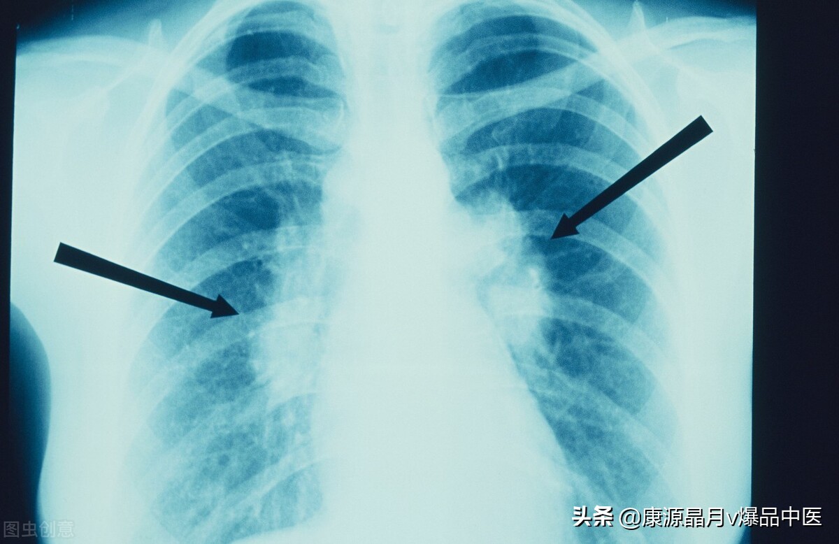 一穴调一病!36种常见病手到病除(收藏)