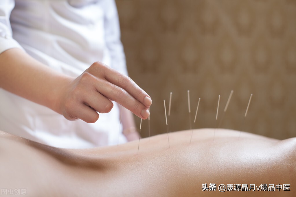 针灸!最高明的医疗手段