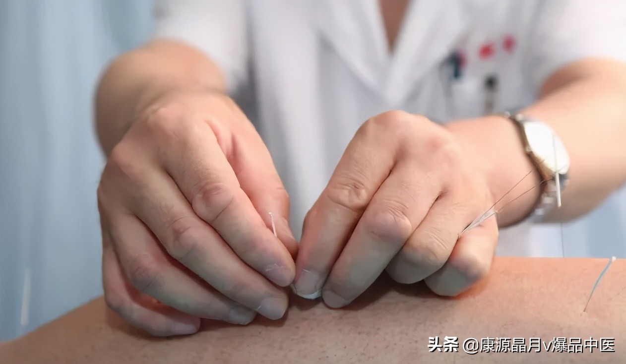 肩痛炎实用经验:运动分析、选穴、针法及放血,照着做有效