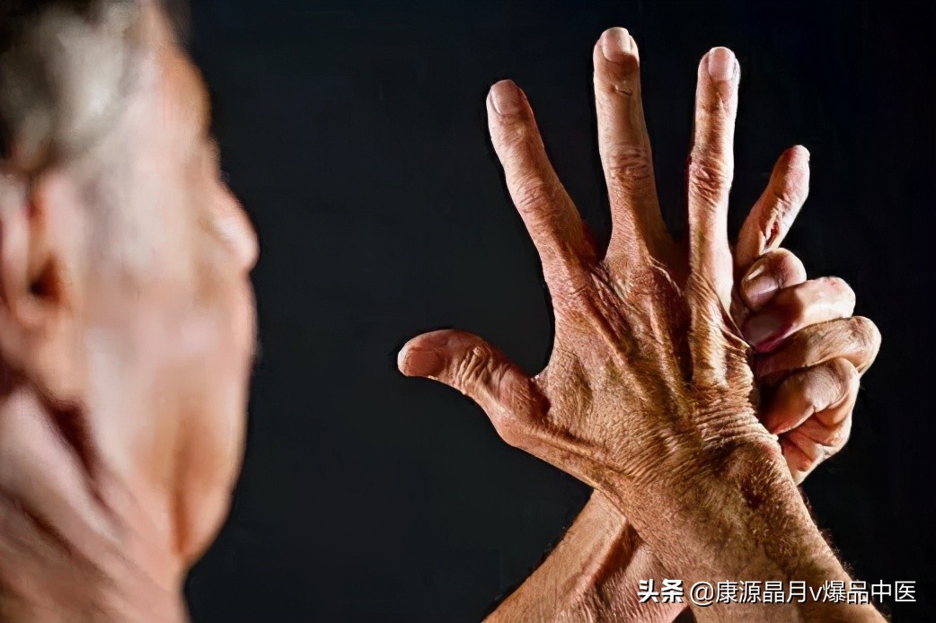 11点要诀,揭秘“类风湿性关节炎”的中医治疗
