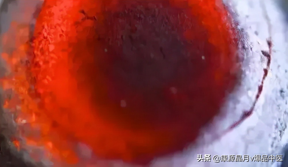 不要乱灸“神阙”,泄你的元气,减你的寿命