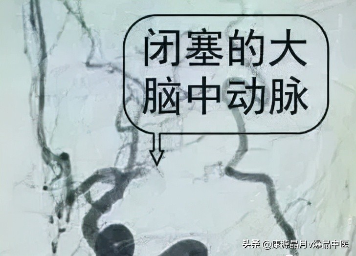 脚上有个“化血栓开关”,打开它,就可清血管、防血栓