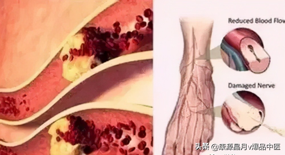 足背拉一拉,等于拉开4条经络,比经络按摩还有功效