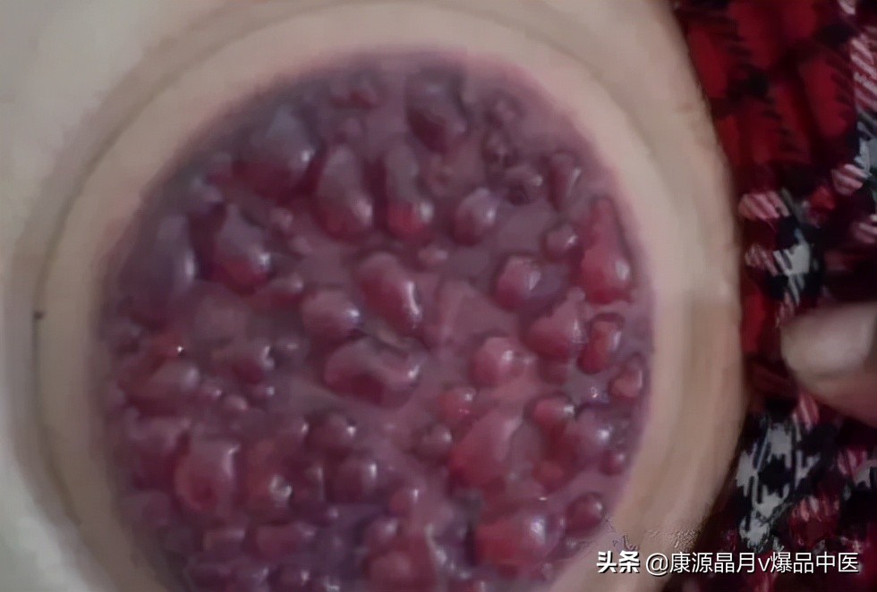 学会这三招,湿气跑光光