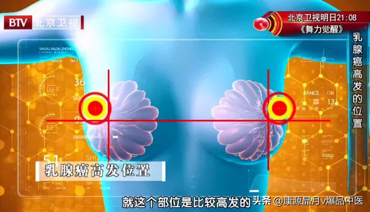 可怕!很多乳腺癌没有症状,一发现就是晚期