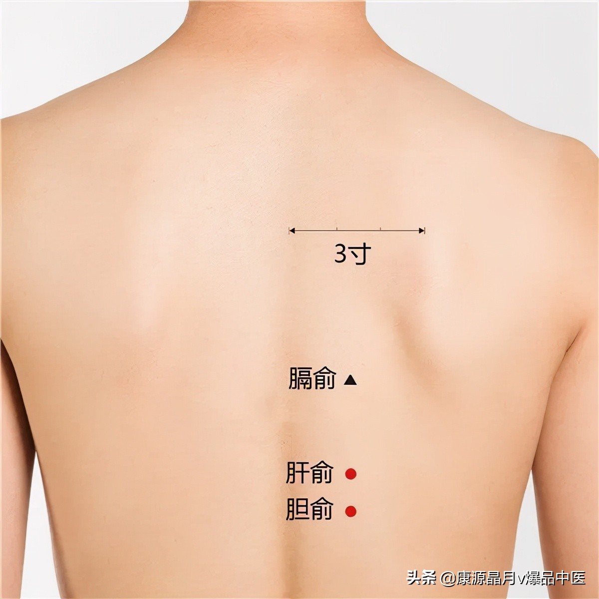 血痣,肝胆病变的前兆?!真的要注意