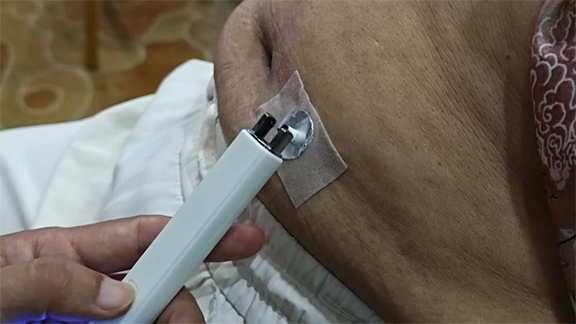 便秘，这三个穴位，交替使用！