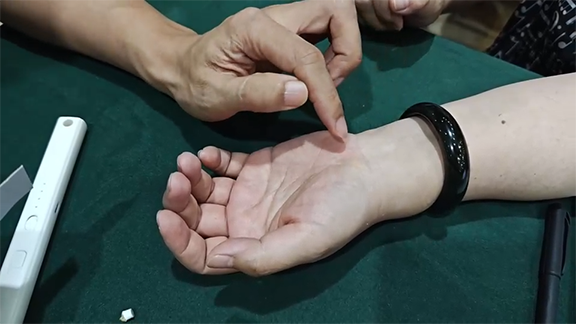 偏头痛，实战组方，超好用！
